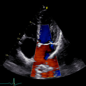 ecco-cardio-doppler