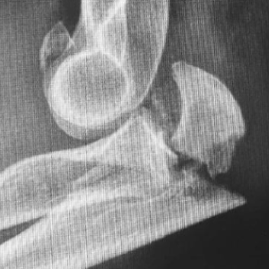 imatge 3a jornada cirurgia ortopèdica i traumatologia